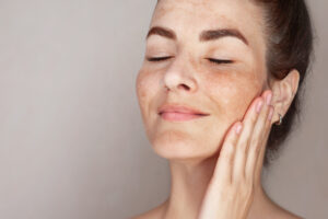 summer skin care and compounded options